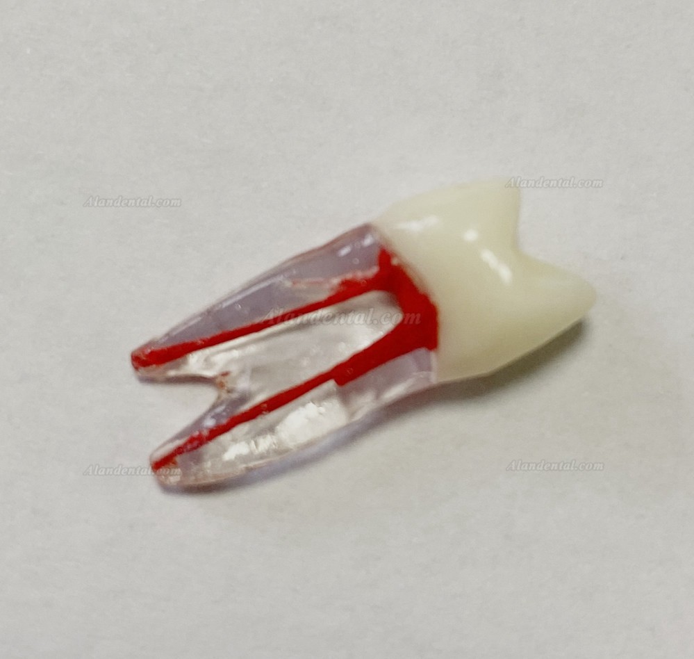 Dental Teeth Model Endo Files Practise Molar Upper Lower Tooth Premolar Root 2/3-Rooted Canal